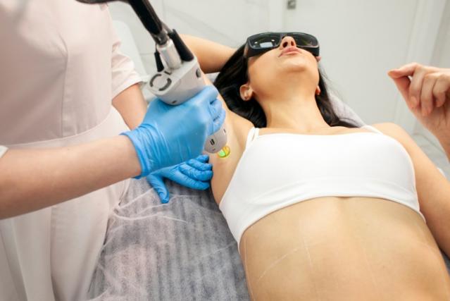 épilation laser